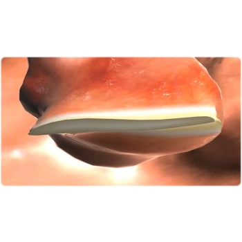 Kleszczyki bipolarne BICLAMP 16 cm
